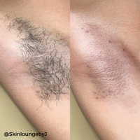 Starsoft Film Hard Wax Microbeads (2.2lb - 30lb)