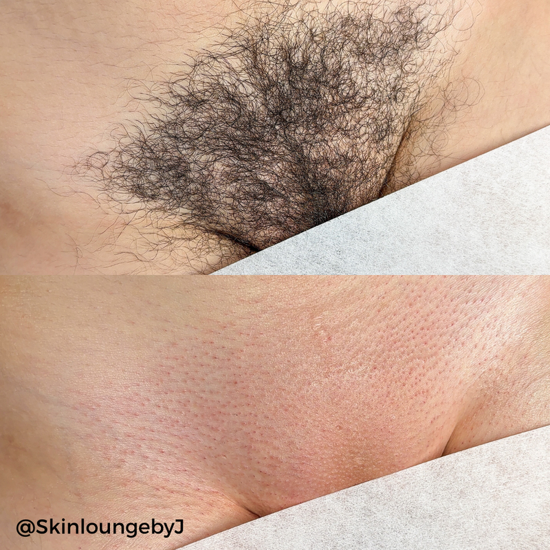 Brazilian Waxing Hard Wax Trio